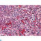 FGR Proto-Oncogene, Src Family Tyrosine Kinase antibody, LS-C814009, Lifespan Biosciences, Western Blot image 