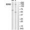 SOS Ras/Rho Guanine Nucleotide Exchange Factor 2 antibody, PA5-50140, Invitrogen Antibodies, Western Blot image 
