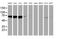 N-Myristoyltransferase 2 antibody, MA5-25841, Invitrogen Antibodies, Western Blot image 