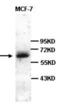 5-hydroxytryptamine receptor 2B antibody, orb313926, Biorbyt, Western Blot image 