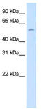 Thyroid Hormone Receptor Beta antibody, TA341821, Origene, Western Blot image 