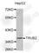 TruB Pseudouridine Synthase Family Member 2 antibody, A3412, ABclonal Technology, Western Blot image 