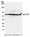 Chaperonin Containing TCP1 Subunit 4 antibody, NBP2-41361, Novus Biologicals, Western Blot image 