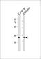 Sphingosine-1-Phosphate Receptor 2 antibody, MBS9216805, MyBioSource, Western Blot image 