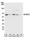 Enhancer Of MRNA Decapping 3 antibody, A303-986A, Bethyl Labs, Western Blot image 