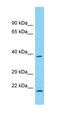 DDB1 And CUL4 Associated Factor 4 antibody, orb326959, Biorbyt, Western Blot image 