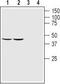 GDNF Family Receptor Alpha 1 antibody, TA328908, Origene, Western Blot image 