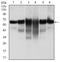 Keratin 5 antibody, ab128190, Abcam, Western Blot image 