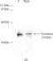 Cytochrome P450 Family 19 Subfamily A Member 1 antibody, NB100-1596, Novus Biologicals, Western Blot image 