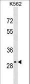 Olfactory Receptor Family 4 Subfamily S Member 2 antibody, LS-C158476, Lifespan Biosciences, Western Blot image 