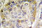 Protein Tyrosine Kinase 2 antibody, LS-C176670, Lifespan Biosciences, Immunohistochemistry paraffin image 