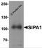Signal-Induced Proliferation-Associated 1 antibody, 6643, ProSci, Western Blot image 