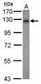 Vezatin, Adherens Junctions Transmembrane Protein antibody, PA5-30652, Invitrogen Antibodies, Western Blot image 