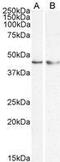 Kruppel Like Factor 15 antibody, GTX89919, GeneTex, Western Blot image 