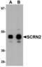 Secernin 2 antibody, LS-B5308, Lifespan Biosciences, Western Blot image 