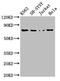 Protein Kinase C Beta antibody, CSB-PA15849A0Rb, Cusabio, Western Blot image 