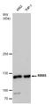 RNA Binding Motif Protein 5 antibody, GTX129783, GeneTex, Western Blot image 