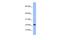 Peptidylprolyl Cis/Trans Isomerase, NIMA-Interacting 4 antibody, GTX45041, GeneTex, Western Blot image 