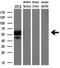 Solute Carrier Family 18 Member A2 antibody, M02232, Boster Biological Technology, Western Blot image 