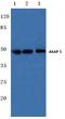 A-Kinase Anchoring Protein 5 antibody, A04234-1, Boster Biological Technology, Western Blot image 