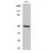 SH3 Domain Containing GRB2 Like, Endophilin B2 antibody, LS-C383343, Lifespan Biosciences, Western Blot image 