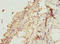 Zinc Finger Protein 24 antibody, LS-C676751, Lifespan Biosciences, Immunohistochemistry paraffin image 