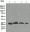 O-6-Methylguanine-DNA Methyltransferase antibody, ab108630, Abcam, Western Blot image 