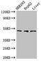 Acyl-CoA Dehydrogenase Short/Branched Chain antibody, CSB-PA001128LA01HU, Cusabio, Western Blot image 