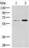 Adaptor Related Protein Complex 1 Subunit Mu 2 antibody, A10144, Boster Biological Technology, Immunohistochemistry frozen image 