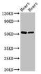 SHE antibody, CSB-PA730142LA01HU, Cusabio, Western Blot image 