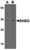 Sex Hormone Binding Globulin antibody, PA5-38010, Invitrogen Antibodies, Western Blot image 
