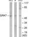 G Protein-Coupled Receptor Kinase 7 antibody, EKC1883, Boster Biological Technology, Western Blot image 