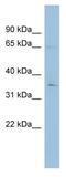 YTH N6-Methyladenosine RNA Binding Protein 1 antibody, ab99080, Abcam, Western Blot image 