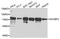 Insulin Like Growth Factor 2 MRNA Binding Protein 3 antibody, A2750, ABclonal Technology, Western Blot image 