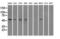 Fumarate Hydratase antibody, LS-C114773, Lifespan Biosciences, Western Blot image 