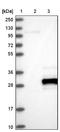 Ubiquitin Conjugating Enzyme E2 E3 antibody, NBP1-86884, Novus Biologicals, Western Blot image 