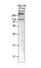 SWI/SNF Related, Matrix Associated, Actin Dependent Regulator Of Chromatin, Subfamily A, Member 5 antibody, NBP2-59190, Novus Biologicals, Western Blot image 