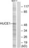 Ribosomal RNA Processing 8 antibody, LS-C119843, Lifespan Biosciences, Western Blot image 