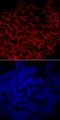 Glucosylceramidase Beta 3 (Gene/Pseudogene) antibody, MAB59691, R&D Systems, Immunofluorescence image 