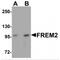 FRAS1 Related Extracellular Matrix 2 antibody, MBS150503, MyBioSource, Western Blot image 