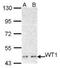 Wilms tumor 1 antibody, NBP1-31314, Novus Biologicals, Western Blot image 