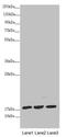 NADH:Ubiquinone Oxidoreductase Subunit A12 antibody, LS-C676130, Lifespan Biosciences, Western Blot image 