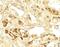 Calcium Sensing Receptor antibody, GTX31574, GeneTex, Immunohistochemistry paraffin image 