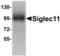 Sialic Acid Binding Ig Like Lectin 11 antibody, A12601, Boster Biological Technology, Western Blot image 