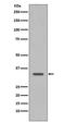 Cyclin Dependent Kinase 1 antibody, M00209-3, Boster Biological Technology, Western Blot image 