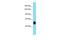 Transmembrane Serine Protease 3 antibody, PA5-70709, Invitrogen Antibodies, Western Blot image 