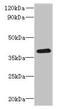 Radial Spoke Head 14 Homolog antibody, CSB-PA887042LA01HU, Cusabio, Western Blot image 