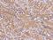 Glucosamine-6-Phosphate Deaminase 1 antibody, 200571-T08, Sino Biological, Immunohistochemistry paraffin image 