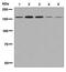 Amylo-Alpha-1, 6-Glucosidase, 4-Alpha-Glucanotransferase antibody, ab133720, Abcam, Western Blot image 