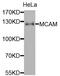 Melanoma Cell Adhesion Molecule antibody, orb135887, Biorbyt, Western Blot image 